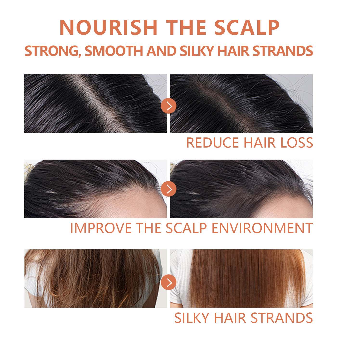 OEM Yeast Scalp Treatment Shampoo – Probiotic & Fermented Yeast Extract for Dandruff, Itchy Scalp & Hair Strength | Private Label Biotin Shampoo for Brands - Image 4