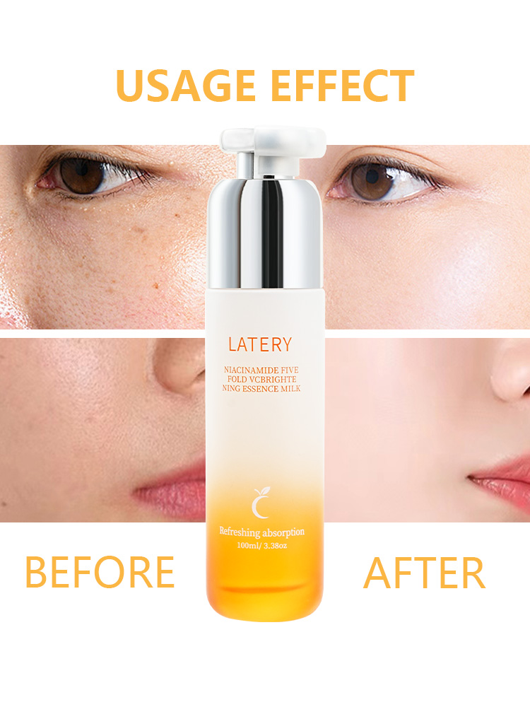 OEM Niacinamide VC Essence Milk | Private Label - Image 4