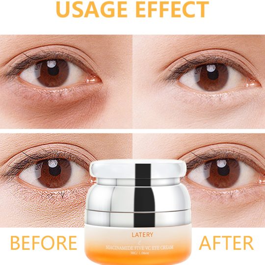OEM Niacinamide VC Eye Cream | Private Label