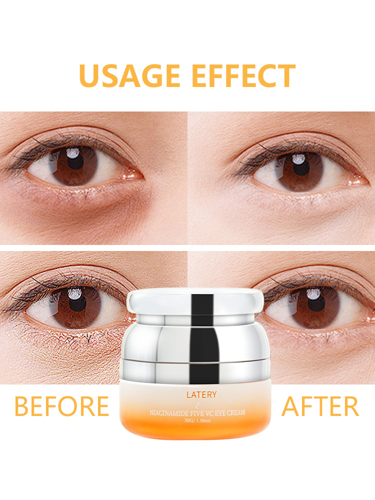 OEM Niacinamide VC Eye Cream | Private Label