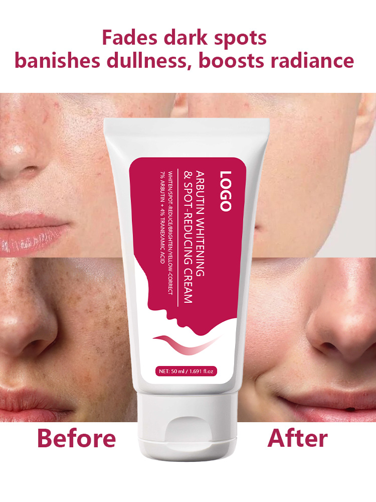 OEM Arbutin Brightening Cream | Private Label Skincare - Image 5