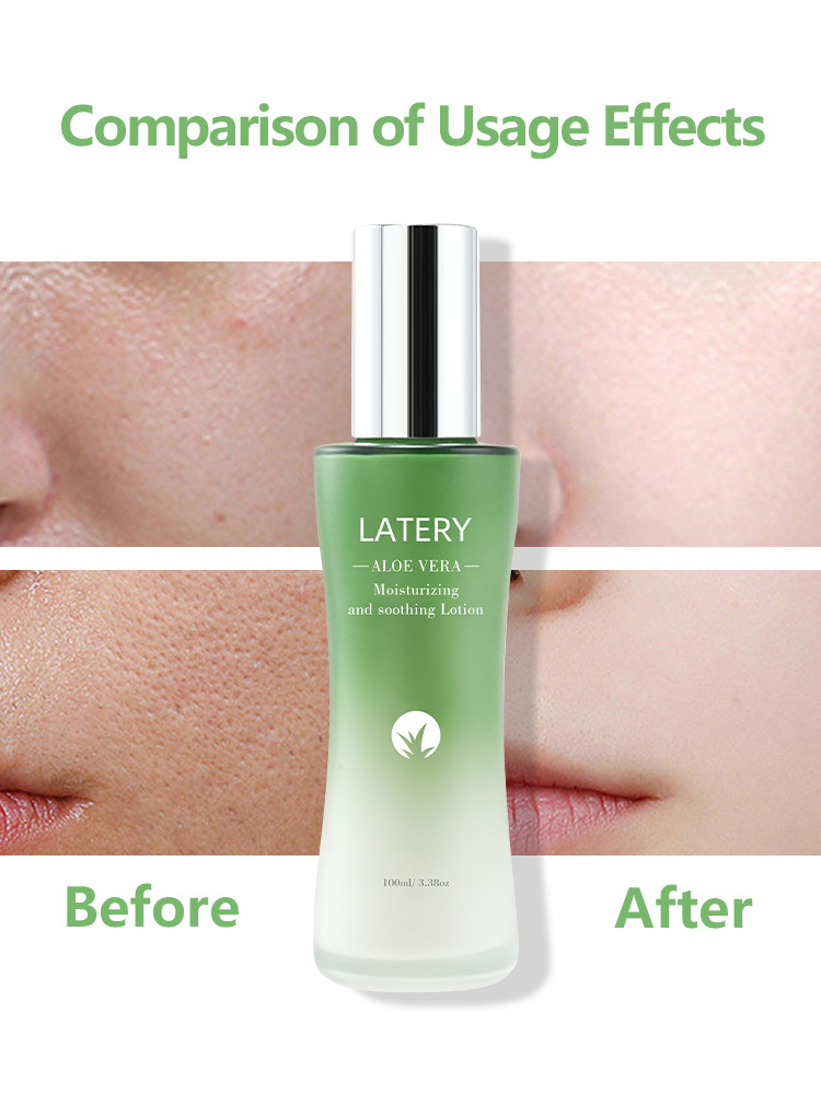 OEM Aloe Vera Soothing Lotion | Private Label - Image 4