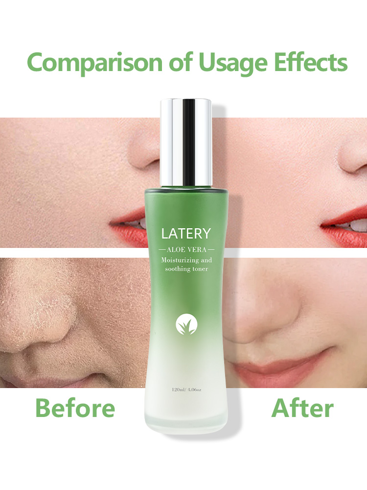 OEM Aloe Vera Toner | Private Label Skincare - Image 3