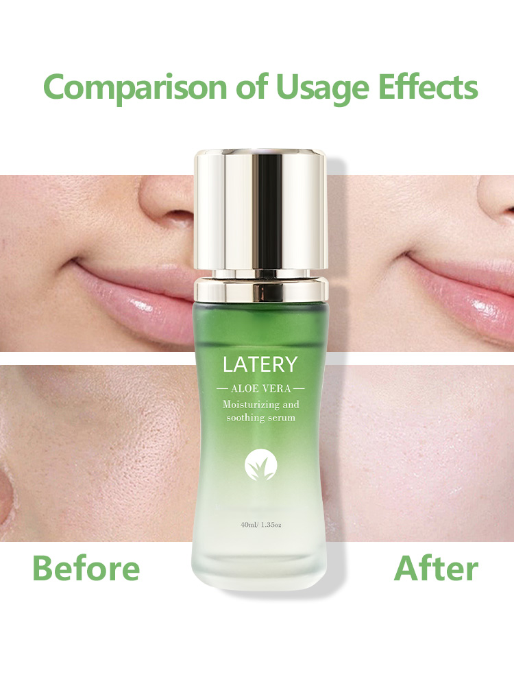 OEM Aloe Vera Soothing Serum | Private Label Skincare - Image 4