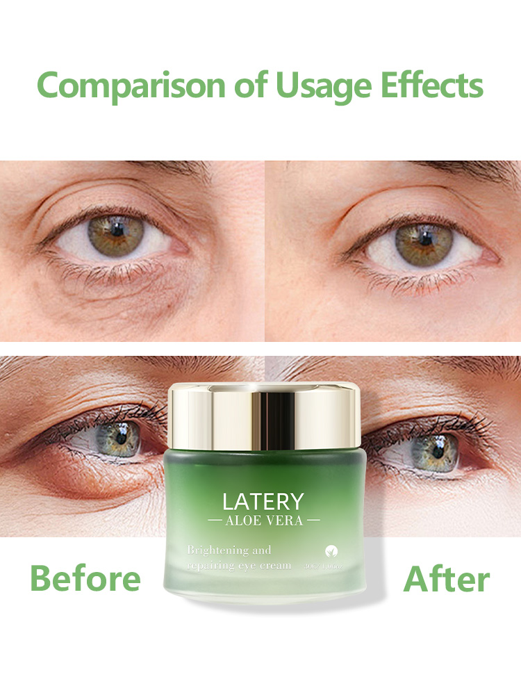 OEM Aloe Vera Brightening Eye Cream | Private Label - Image 3