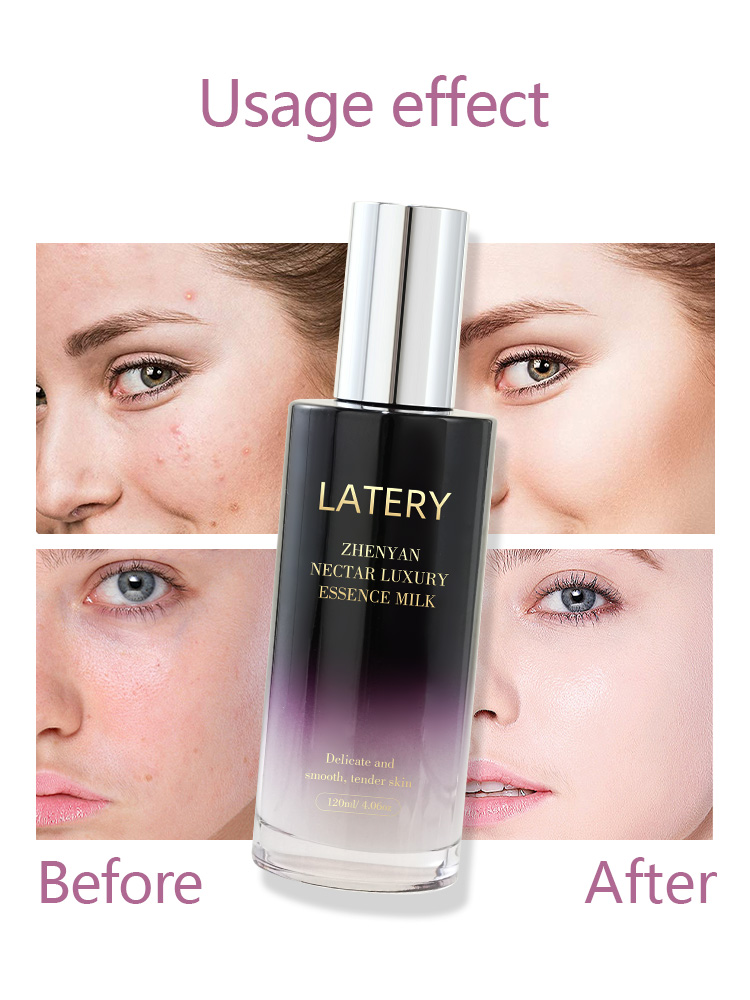 OEM Luxury Essence Milk | Private Label Skincare - Image 5