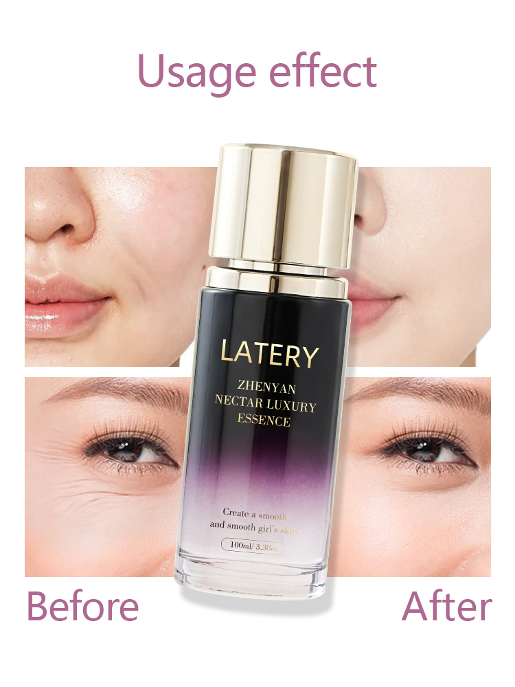 OEM Centella Luxury Essence | Private Label Skincare - Image 5