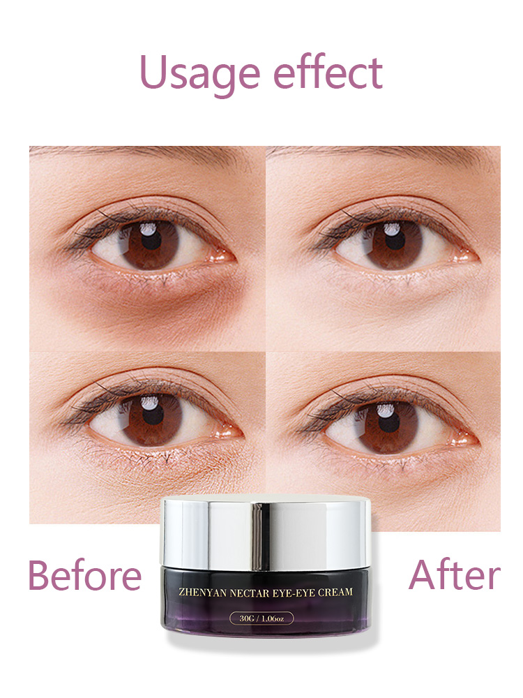 OEM Centella Luxury Eye Cream | Private Label - Image 5