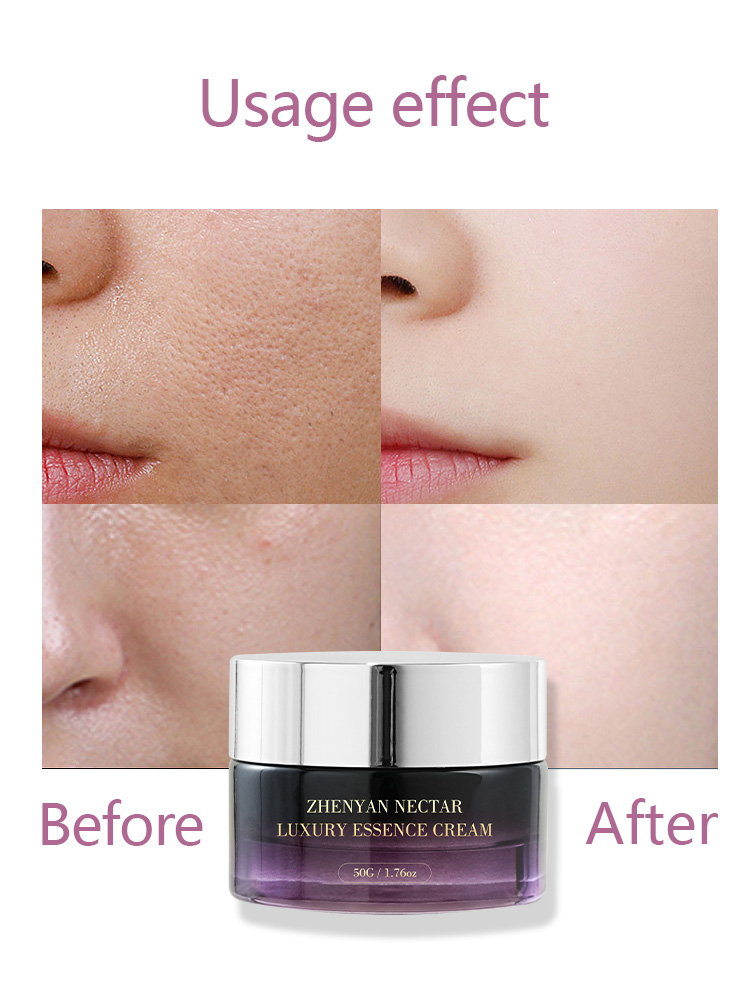 OEM Centella Luxury Essence Cream | Private Label - Image 5