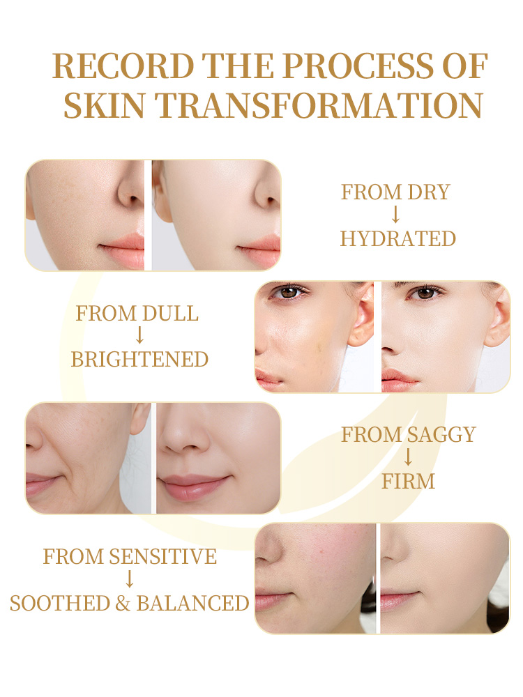 OEM Black Gold Skincare Set | Private Label - Image 4